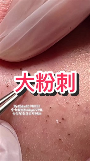 Elaine skin care臉部保養｜清粉刺｜皮膚諮詢｜行天宮店｜板新店｜民權店 全省皆有店家/歡迎詢問 #粉刺 #保養 #護膚 #生活 #素顏