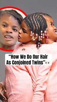 “How We Do Our Hair As Conjoined Twins” #shorts #conjoinedtwins #survivorstory