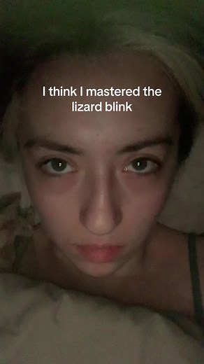 Mastering the Lizard Blink: TikTok Blink Challenge