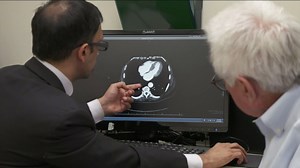 How screening can save lives for people with hepatitis C