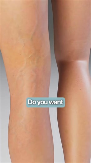 "I've tried so many compression socks. EverSock is the only brand that works properly. My legs have improved dramatically within days of wearing them. They are easy to put on and don’t leave painful marks, they also fit my wide calves perfectly. I bought 4 pairs for the price of 2 during their sale which is great value for money" - Amanda H. | EverSock