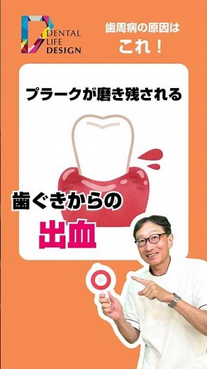 How does periodontal disease develop? We ask Professor Amano, a master of preventive dentistry! #...
