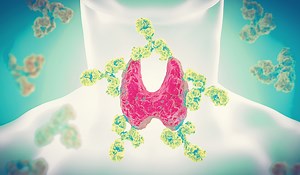 Treatment Options When You Have A High TSH