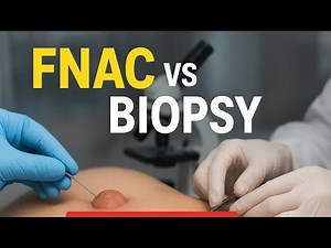 FNAC vs Biopsy | Difference Explained with Examples