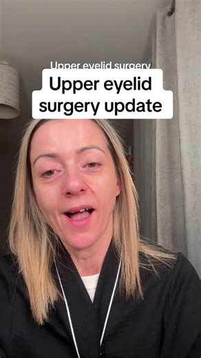 Upper Eyelid Surgery Update: What You Need to Know