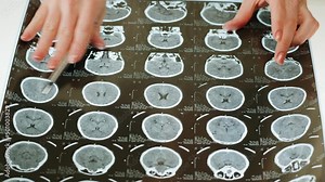 X-ray, Magnetic resonance image of head, human brain MRI close-up. Advanced research of body, doctor examining checkup tomography.