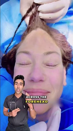 This Surgery Can Instantly Refresh Your Face