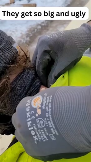 OMG 🥵 #pimples #pores #blackheads #oilyskin #whiteheads #pimple #blemishes #skinproblems #acnetreatment #blackheadremoval #acneproblems #dryskin #facecare #sunblock #blackheadremover #blackheadremoval | Pimple 2022