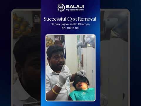 Facial Cyst Removal Using Laser | Advanced Treatment by Dr. Sanjeeb