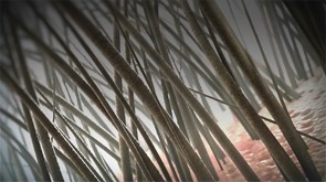 Hair, Tendons, and Skin: Oh My! Biotech's Quest for Tissue Regeneration