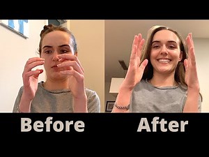 How I Improve My Hand Function | Motor Neuron Disease