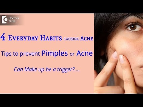 How to prevent pimples naturally?