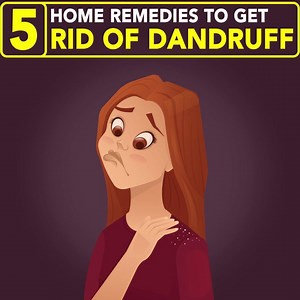 37K views · 665 reactions | 5 Home Remedies To Get Rid Of Dandruff | Health+ | Facebook