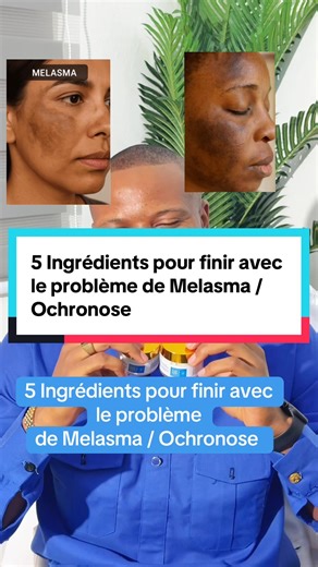 5 Ingrédients pour finir avec le problème de Melasma / Ochronose #CoachYannickIngenieur #melasmatreatment #ochronosetraitement