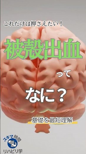 【基礎】被殻出血ってなに？PTなら知っておきたい基礎 #理学療法士国家試験 #理学療法士 #作業療法士国家試験 #作業療法士 #基礎 #脳 #脳出血 #脳卒中 #被殻出血