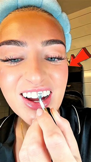 She Tried to Whiten Her Teeth… BIG Mistake 😳