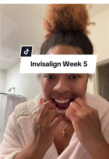 Invisalign Update | week 5… tray not tracking #invisalignsmile #invisalign @Invisalign