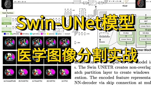毕设有救了！【论文解读 源码复现】基于Swin-UNet模型的医学图像分割实战，AI大佬手把手带你1小时吃透图像分割实战，看完即跑通。比刷剧还爽！AI/深度学习