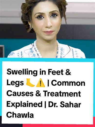 Swelling in Feet & Legs 🦶⚠️ | Common Causes & Treatment Explained | Dr. Sahar Chawla #LegSwelling #FootSwelling #Edema #HealthAwareness #creatorsearchinsights