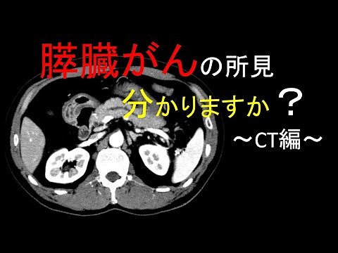【膵臓がん】CT画像所見と鑑別が必要な疾患を紹介します！