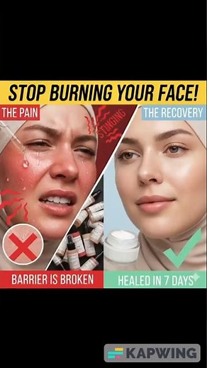 🛑 STOP BURNING YOUR FACE! (How to Fix a Damaged Skin Barrier in 7 Days)