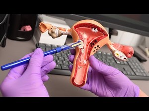 What is the cervix in pregnancy | How Does the Cervix Change in Early Pregnancy?