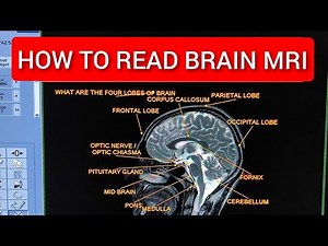 MRI Brain Anatomy and Physiology in English