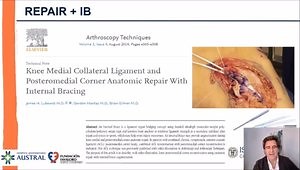 Repair of Medial-Sided Injuries: When and How?