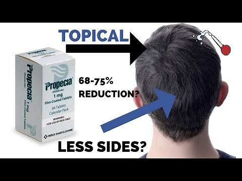 Topical Finasteride for Hair Loss - Free From Side Effects?