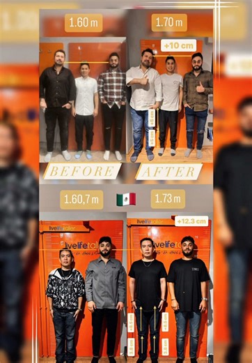 Recovery Journey After Limb Lengthening Surgery