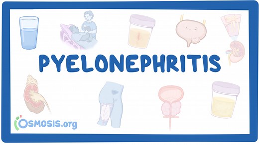 Pyelonephritis: Nursing: Video & Causes | Osmosis