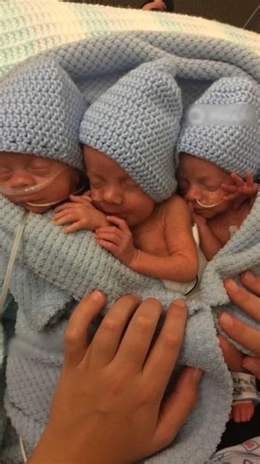 Triplets Baby Birth😍 #triplets #newbornbaby #baby #babyshorts #youtubeshorts #viralvideo #viral