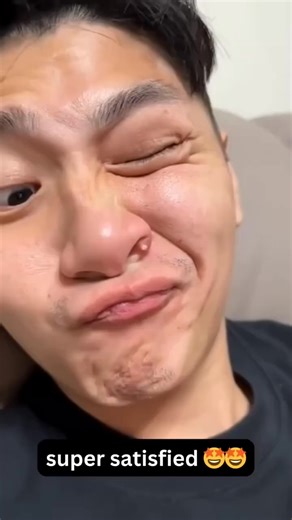 1.3K views |  It looked small, but wait till you see the ending! #drpimplepopper #grossaddiction | Dogs k9+ | Facebook