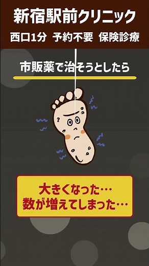 指や足の裏の硬いしこり、正体はウイルス性イボかも
