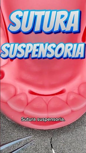 Punto suspensorio en odontología 🦷✂️ #suturasuspensoria #suturas #dentista #tips