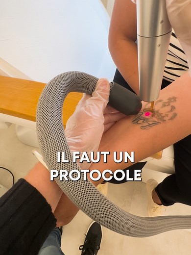 Effacer entièrement un tatouage au laser ? C’est possible, mais pas n’importe comment ! #detatouage #tattooremoval #detatouagelaser #laser