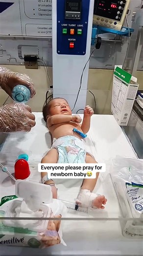 NG Feeding Procedure for Newborn Baby in NICU | Baby Boy | Step-by-Step Guide #newborncare #baby #NewbornBaby #NICUCare #neonatologist