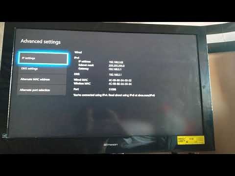 How to fix teredo ip issue on Xbox One and Series X 100% (Still working in 2024)