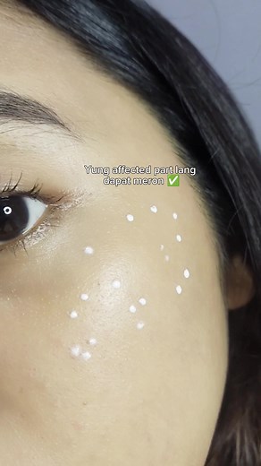 Effective Ways to Remove Warts and Skin Tags on Your Face