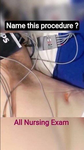 Thoracentesis Procedure Explained | Pleural Tap Step by Step | Nursing & Medical Guide