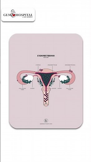 Blocked Fallopian Tubes Explained | IVF & Fertility Solutions