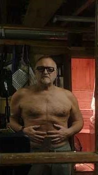 Doc's 4th workout after Open Heart Surgery - the scars!