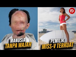 MANUSIA TANPA WAJAH‼️ INILAH 10 ORANG UNIK DAN ANEH YANG ADA DI DUNIA
