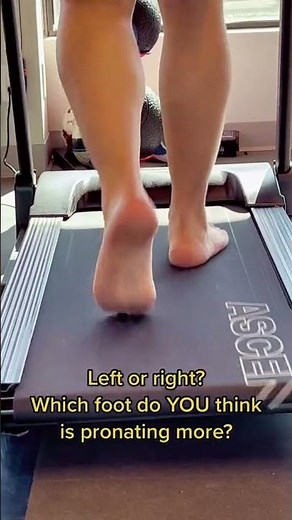 FOOT OVERPRONATION SYNDROME 🦶