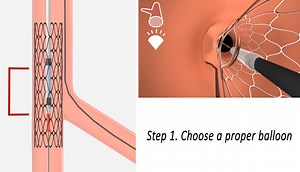 My Toolkit: Why and how to perform Proximal Optimisation Technique (POT)