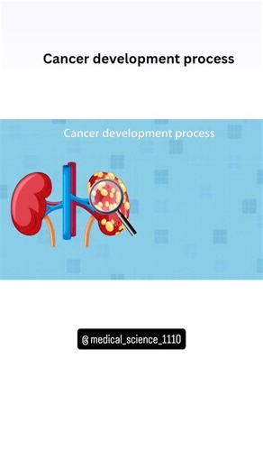 @medical_science_1110 on Instagram: "Follow @medical_science_1110 process of cancer development"