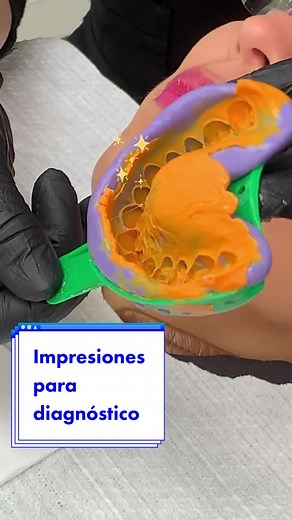 Cómo realizar impresiones dentales efectivas y simples