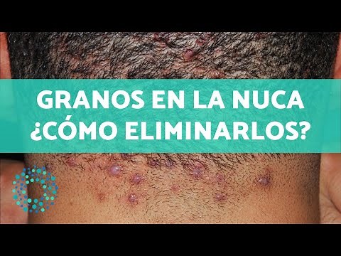 Pimples on the back of the neck - Causes and remedies to eliminate them 🤚🏼