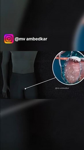 "99% मर्द नहीं जानते इस छुपी हुई बीमारी के बारे में 💔"#MensHealth#HardFlaccidSyndrome#MaleProblems