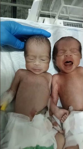 Newborn twin's Baby female NICU incubator care